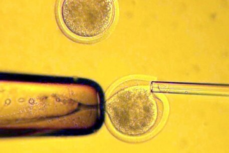 Код мкб 10 перенос эмбрионов