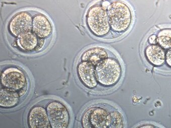 Код мкб 10 перенос эмбрионов